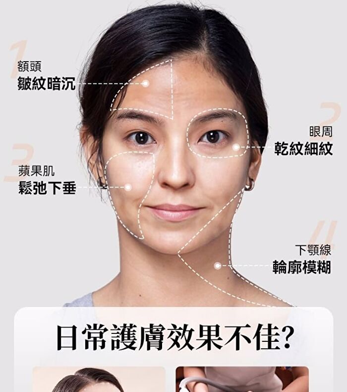 Collagen Revitalizing RF Device Pro - 1 Set