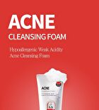Cleansing Foam - 2 Types - Acne