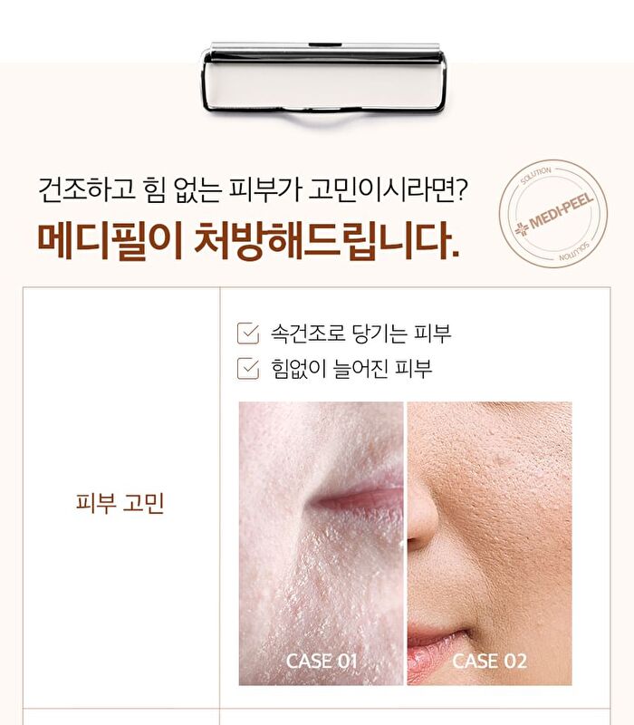 Hyal Kombucha Tea-Tox Cream - 50ml