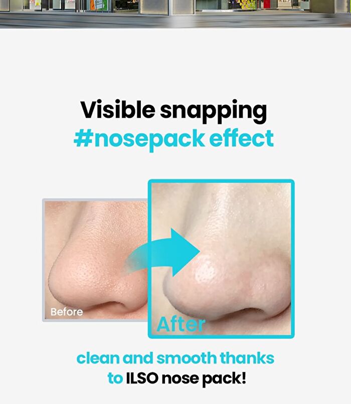 Natural Mild Clear Nose Pack - 5 sets