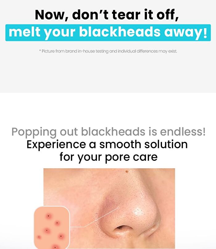 Natural Mild Clear Nose Pack - 5 sets