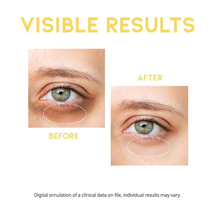 Ootd Dark Circle Eye Serum - 30g