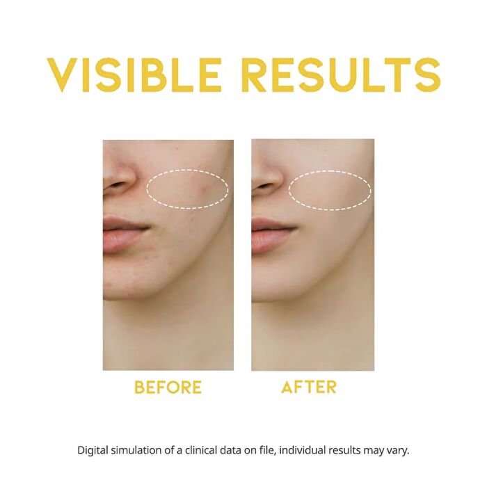 Ootd Dark Spot Vitamin C Serum - 50ml