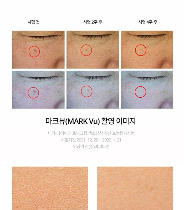 Foretderm Derma Intense Vita-Niacin Toning Cream - 20ml