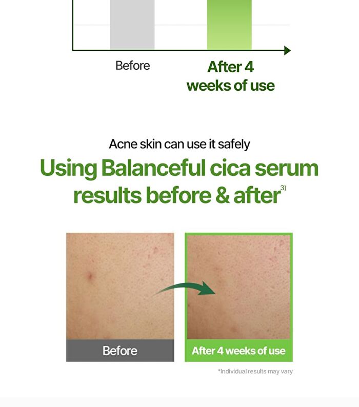 Balanceful Cica Serum Mini - 10ml