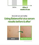 Balanceful Cica Serum Mini - 10ml