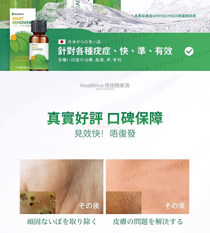 Wart Care Fluid - 10ml