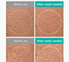BP Pore Clear Facial Mask Set - 25ml x 5 pcs
