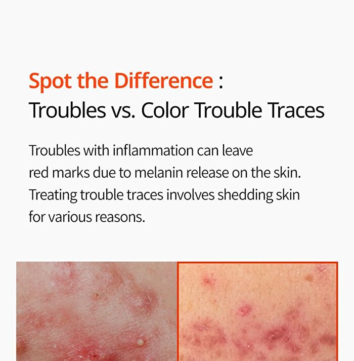 Exosome Repair Toner - 300ml