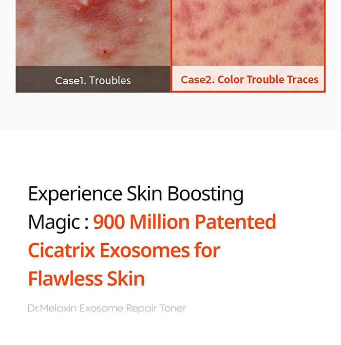 Exosome Repair Toner - 300ml
