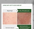 Lipino Anti-Fatty Acid Noncomedo Cream - 50ml