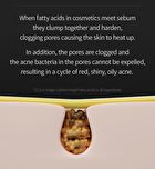 Lipino Anti-Fatty Acid Noncomedo Cream - 50ml