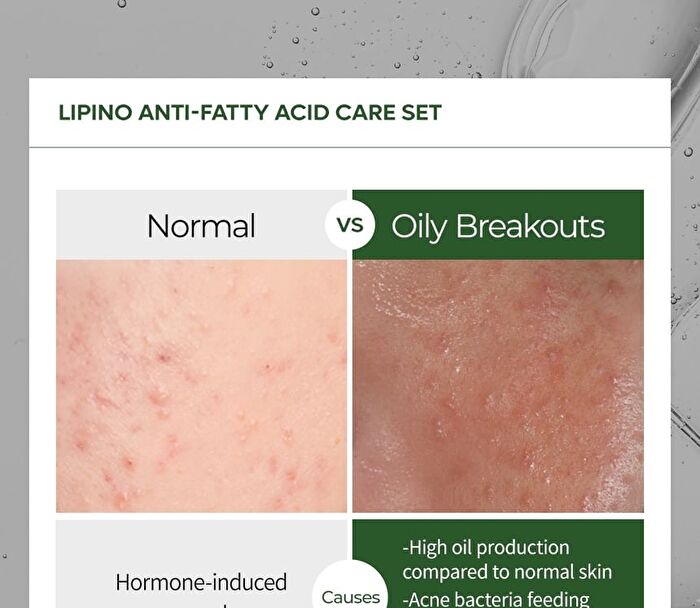 Lipino Anti-Fatty Acid Oil Ampoule - 30ml