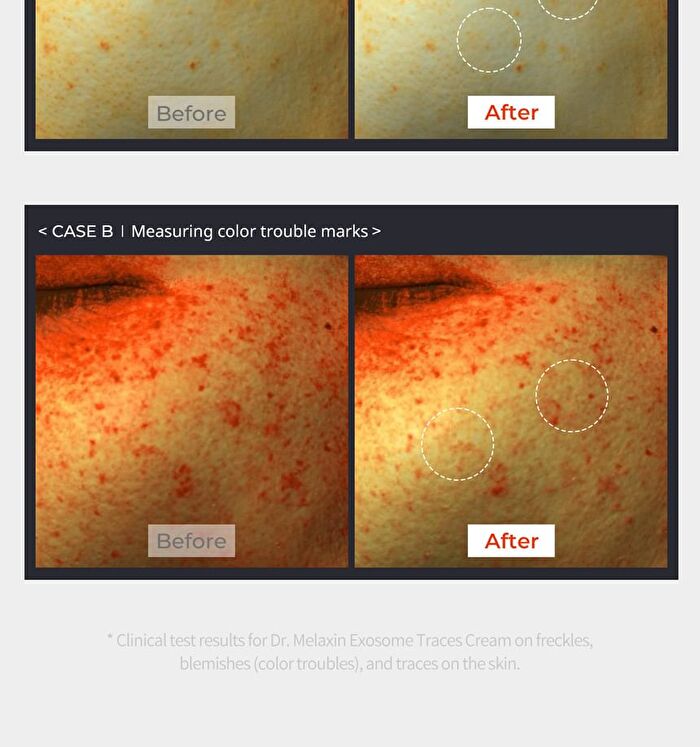 Exosome Repair Cream - 50ml