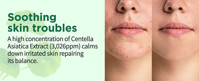 Beaudiani Cica Ampoule Mask - 100 pads