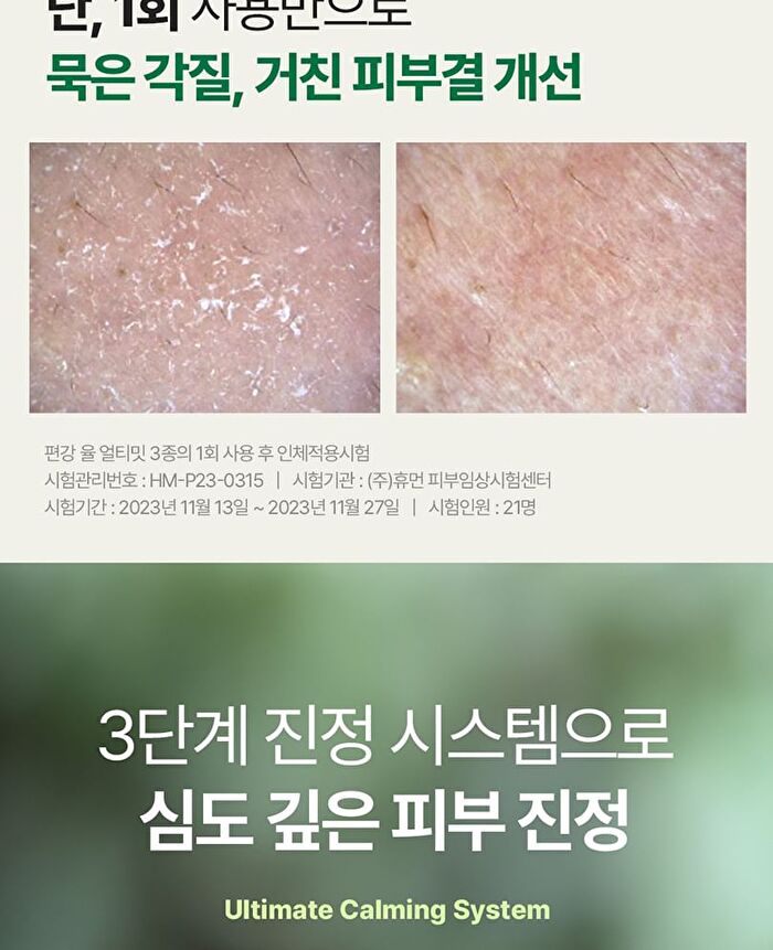 Ultimate Calming Solution Cream - 30ml