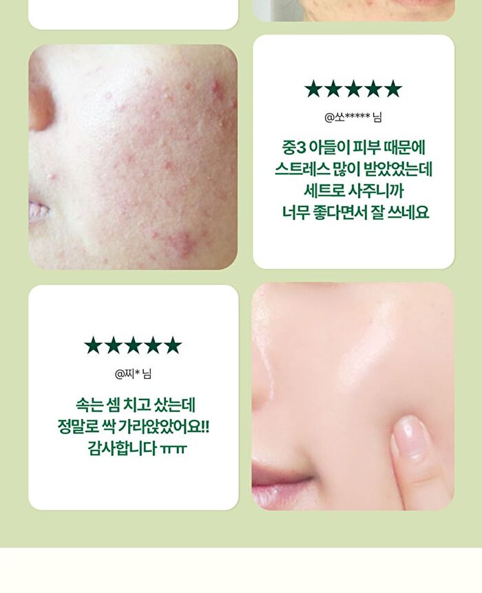 Ultimate Calming Solution Cream - 30ml