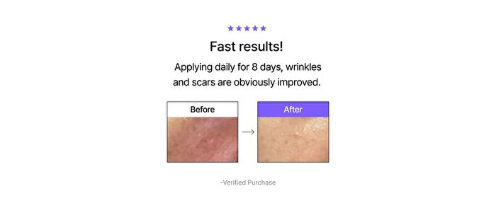 Vitamin A-mazing Bakuchiol Night Cream Mini - 10g