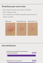 Retinol Intense Reactivating Serum - 2023 Version - 30ml