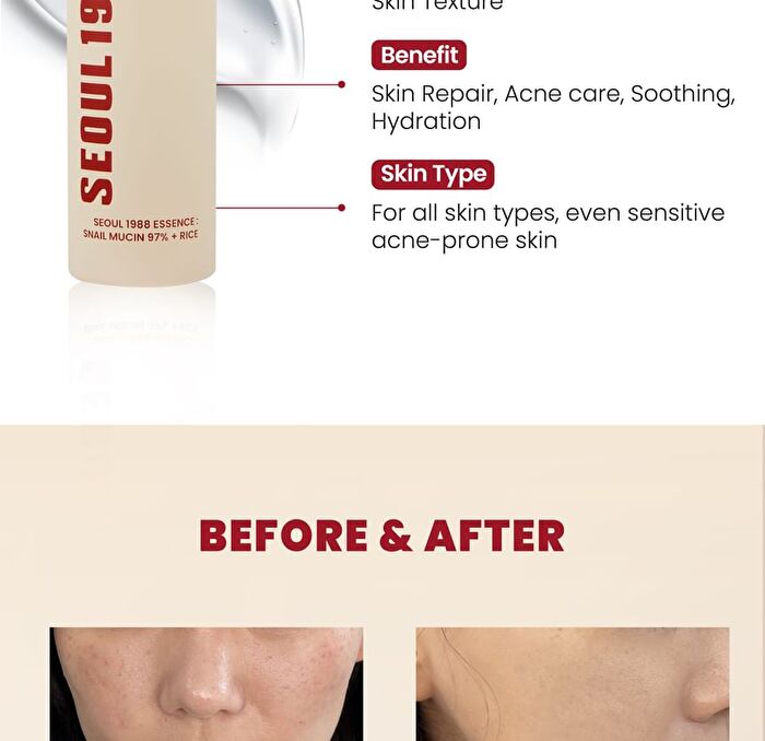 Ksecret SEOUL 1988 Essence : Snail Mucin 97% + Rice - 100ml
