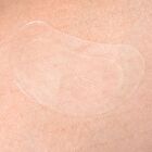 Zero Spot Vita Cica Patch Big - 6 pcs