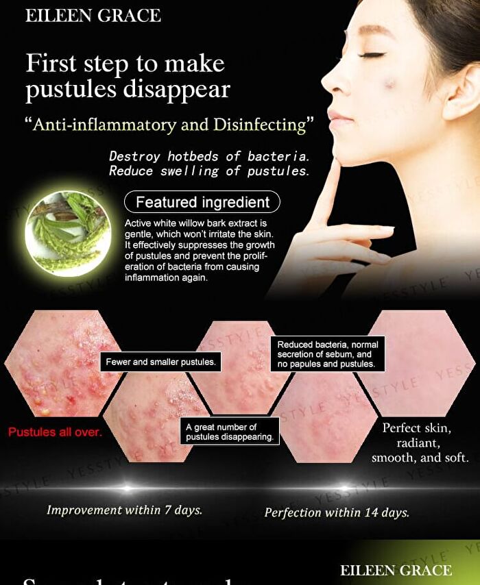 Eileen Grace Acne Prevent Essences - 30ml