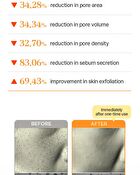 Expert Pore Ampoule Mask - 30ml