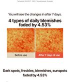 T\'else Red Orange Niacinamide Serum - 30ml