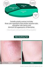 AHA, BHA, PHA 30 Days Miracle Serum 50ml - 2024 Version - 50ml