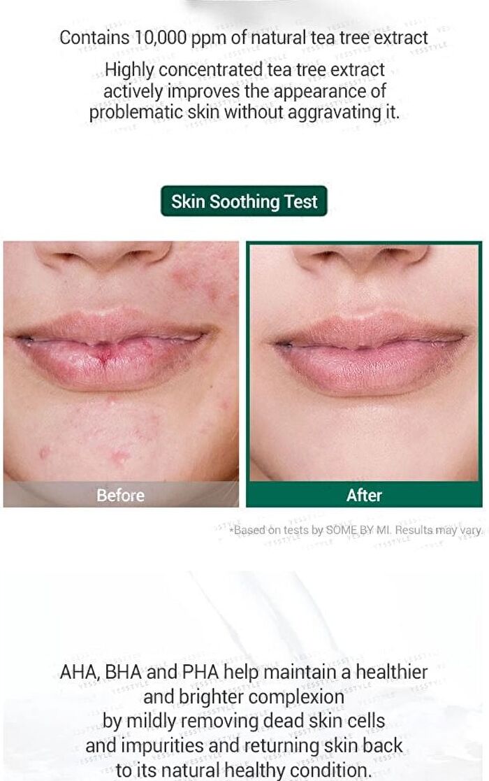 AHA, BHA, PHA 30 Days Miracle Serum 50ml - 2024 Version - 50ml