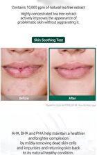 AHA, BHA, PHA 30 Days Miracle Serum 50ml - 2024 Version - 50ml