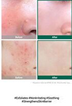 AHA, BHA, PHA 30 Days Miracle Serum 50ml - 2024 Version - 50ml