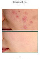 AHA, BHA, PHA 30 Days Miracle Serum 50ml - 2024 Version - 50ml