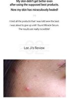 AHA, BHA, PHA 30 Days Miracle Serum 50ml - 2024 Version - 50ml