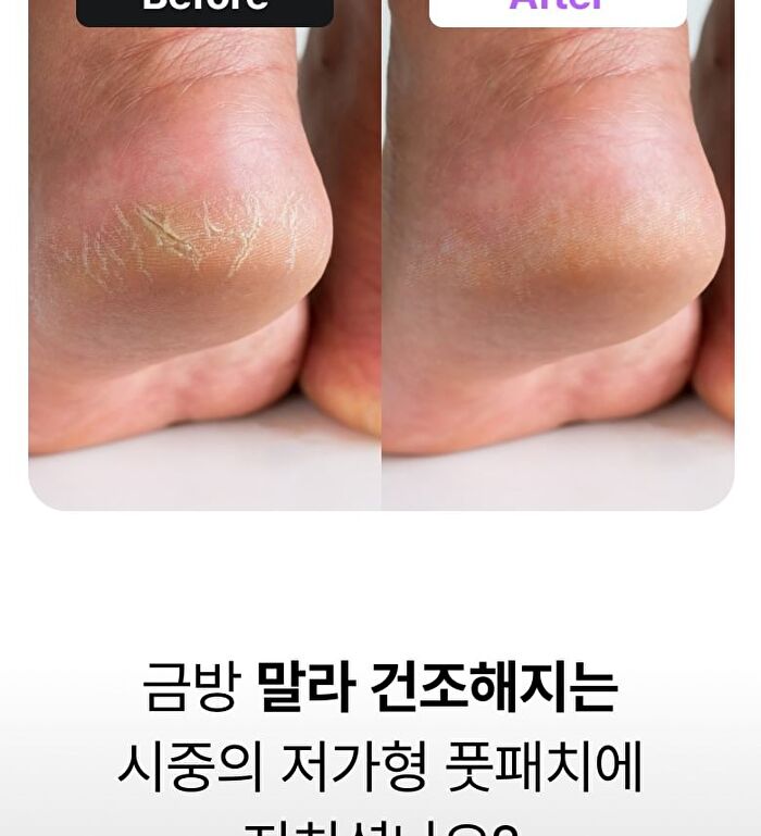 Shea Butter Sleeping Heel Patch - 0.5g x 10 patches
