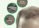 Cica Peptide Anti Hair Loss Derma Scalp Tonic - 150ml