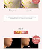 Dermatory Retinal Spicule Wrinkle & Neck Cream - 50ml