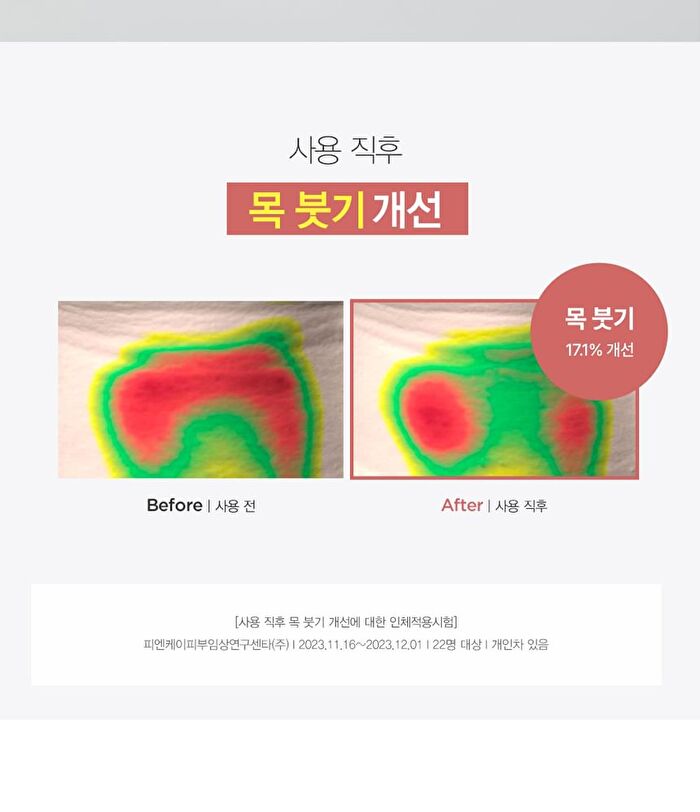 Dermatory Retinal Spicule Wrinkle & Neck Cream - 50ml