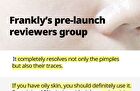 Frankly Niacinamide 15% + Zinc Beads Serum - 30ml