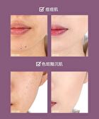 Amortals Rejuvenating 3 Colors Concealer - 2 Types - 01# Natural - 1.2g*3