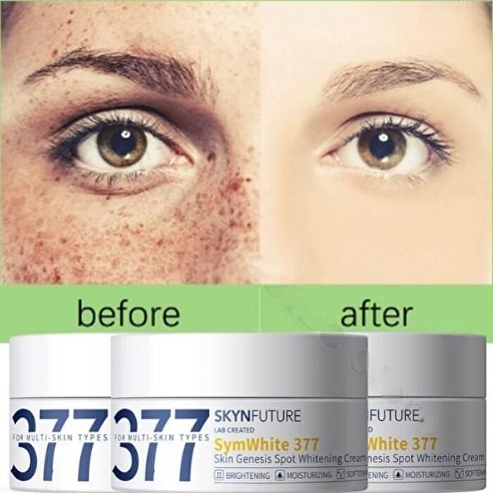 Sightfuture SymWhite 377 Skin Genesis Spot Whitening Cream - 30g