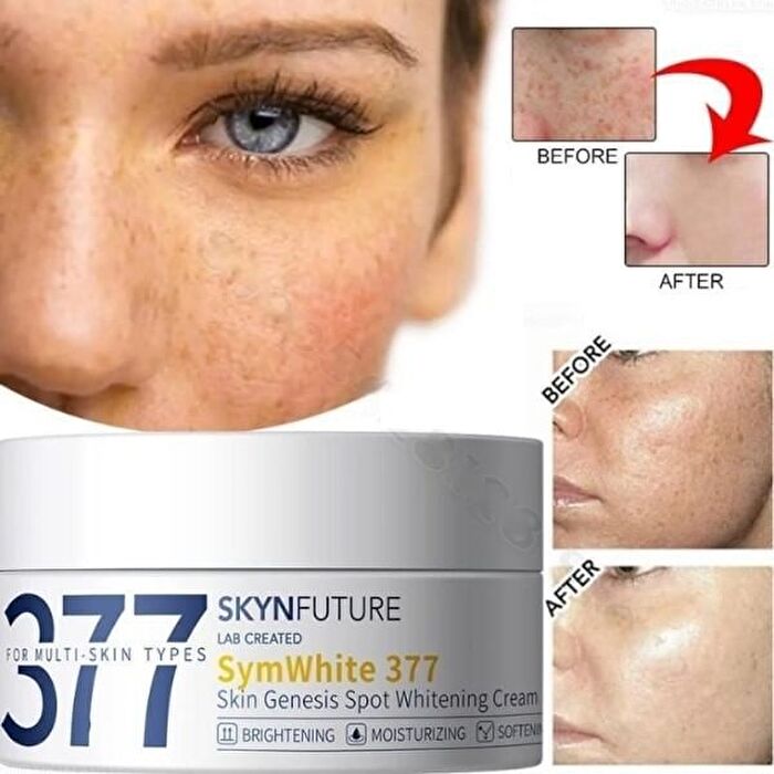 Sightfuture SymWhite 377 Skin Genesis Spot Whitening Cream - 30g