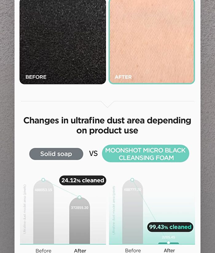 Micro Black Cleansing Foam - 120ml
