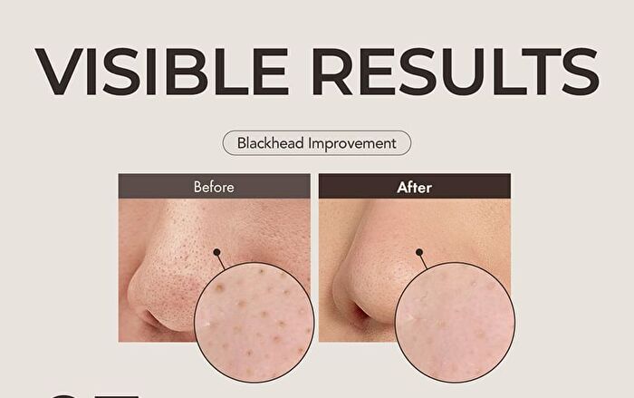 Blackhead Scrub Balm - 20g