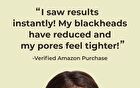 Blackhead Scrub Balm - 20g
