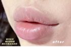 Glitter Lip Gloss - 2 Colors - #05 - 10g