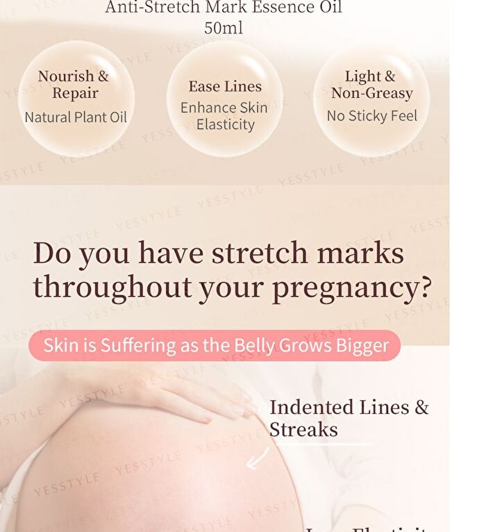 Preg Mommy Stretch Mark Essence Oil - 50ml