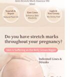 Preg Mommy Stretch Mark Essence Oil - 50ml