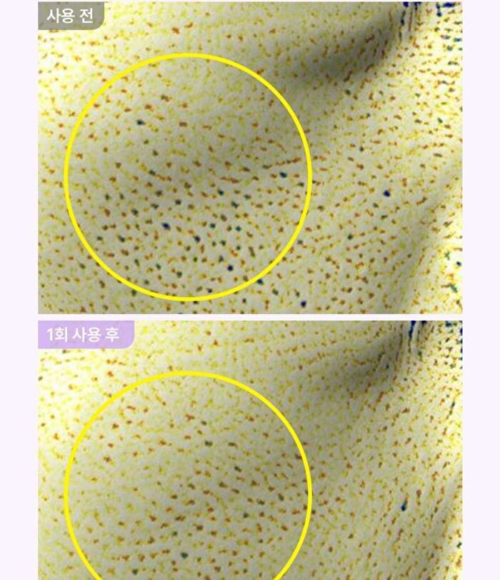 Bioheal Boh Probioderm Collagen Remodeling Serum Pads - 2024 Version - 70 pads