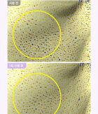 Bioheal Boh Probioderm Collagen Remodeling Serum Pads - 2024 Version - 70 pads